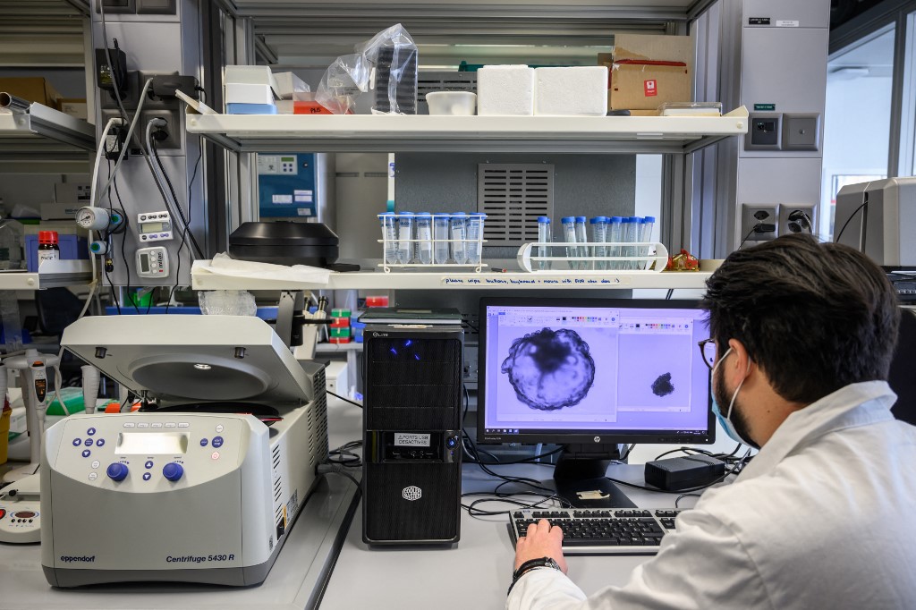 Un chercheur pose avec un moniteur montrant une tumeur dans un laboratoire d'expérimentation animale de l'Université de Genève, le 18 janvier 2022. (Photo, AFP)