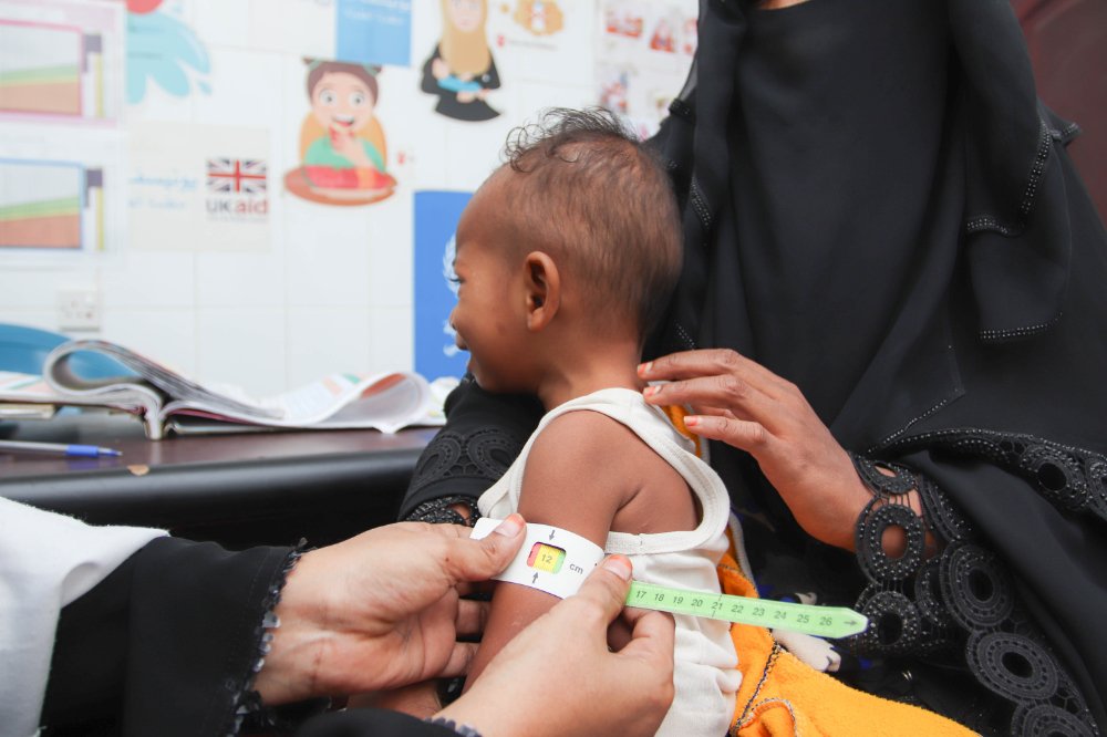 Le Programme alimentaire mondial (PAM) vise à atteindre 1,7 million d'enfants et de mères dans plus de 3 000 centres de santé à travers le Yémen. Les taux de malnutrition augmentent avec chaque année de guerre au Yémen. (Photo, PAM)