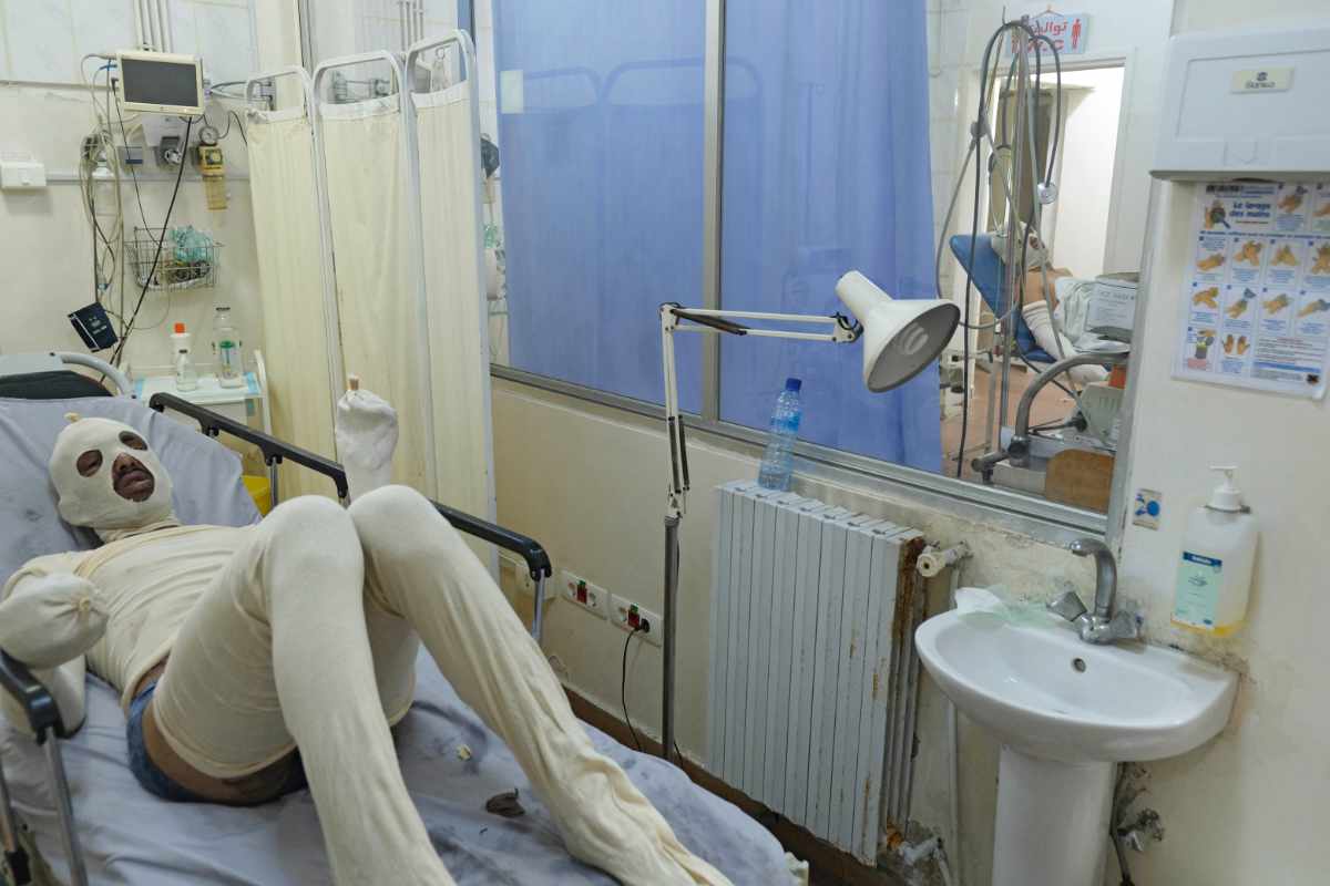 Un homme, brûlé lors de l'explosion d'un réservoir de carburant à Akkar, au Liban, sur fond de pénurie de carburant, est alité à l'hôpital As-Salam de Tripoli, le 15 août 2021. (AFP)