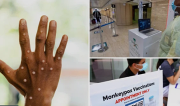 L'Arabie saoudite doit-elle s'inquiéter de la variole du singe ?