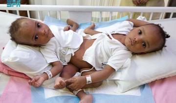 Une intervention chirurgicale complexe débute à Riyad pour séparer des sœurs siamoises nigérianes