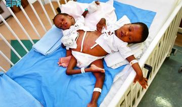 Des experts saoudiens commencent l’opération de séparation de jumeaux siamois tanzaniens