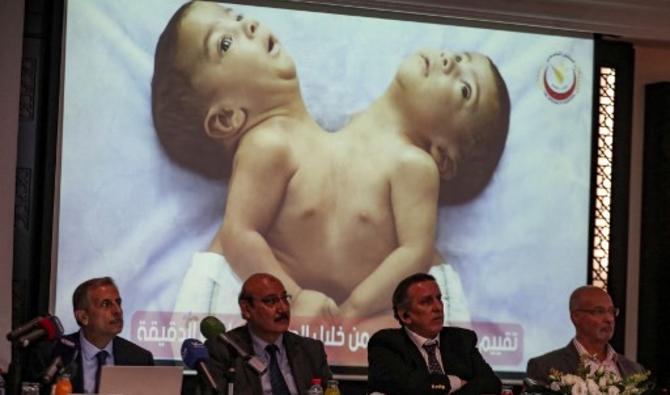 L'intervention a eu lieu en juillet alors que les deux siamois étaient âgés de sept mois. Mais l'équipe médicale a voulu attendre qu'ils soient hors de danger avant de l'annoncer, le 3 octobre 2021 (Photo, AFP)