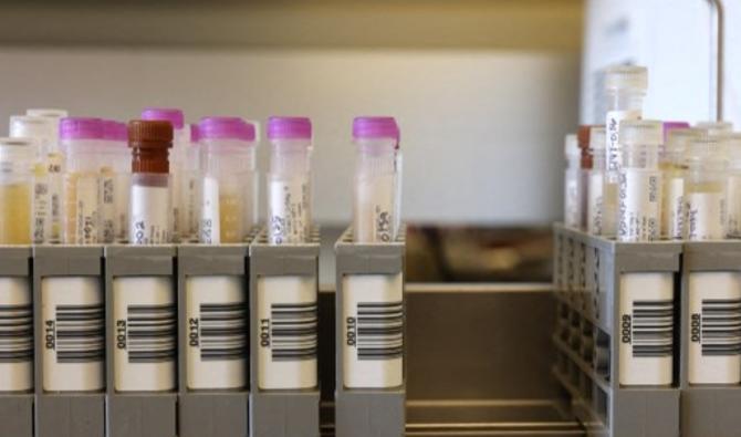 Des chercheurs du UW Medicine Retrovirology Research Lab travaillent sur des échantillons du vaccin anti-Covid Novavax, le 12 février 2021 à Seattle, Washington. (Photo, AFP)