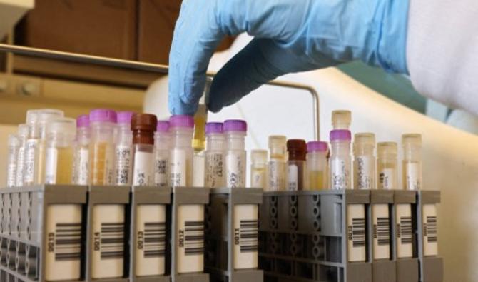Des chercheurs du UW Medicine Retrovirology Research Lab du Harborview Medical Center travaillent sur des échantillons de l'essai clinique de vaccin Novavax, le 12 février 2021 à Seattle, Washington (Photo, AFP) 